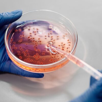 Rappresentazione microscopica di batteri; tutela legale per errori medici in infettivologia, ritardi diagnostici e terapie antibiotiche inadeguate